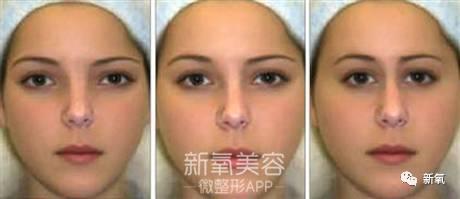 孙佳仁朱智勋:双眼皮一定比单眼皮美么？有哪些单眼皮却很美的明星？