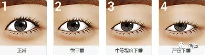 孙佳仁朱智勋:双眼皮一定比单眼皮美么？有哪些单眼皮却很美的明星？