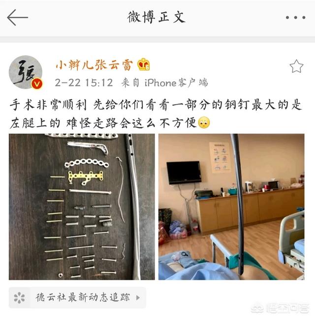 潘粤明车祸:张云雷发文报平安，他的腿到底怎么了