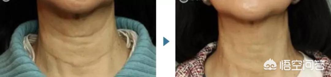 泽尻英龙华图片:有哪些美女明星后来变成了“丑女”？