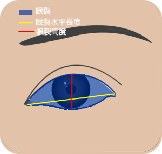 开内外眼角:割双眼皮、开内外眼角可以使眼睛变大吗？为什么？