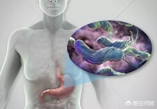 哪些方法和食物可以帮助消灭幽门螺杆菌？