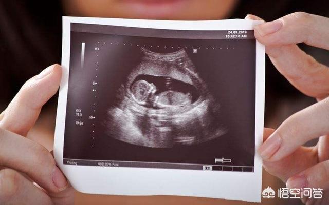 怀孕36周时胎儿发育情况是怎样的？胎儿体重有