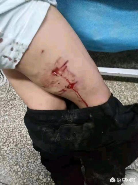 滦县救狗事件:高速拦车救狗，拦车者负什么法律责任？