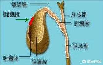 外科疾病总结:有哪些胆囊疾病呢？该怎样预防呢？