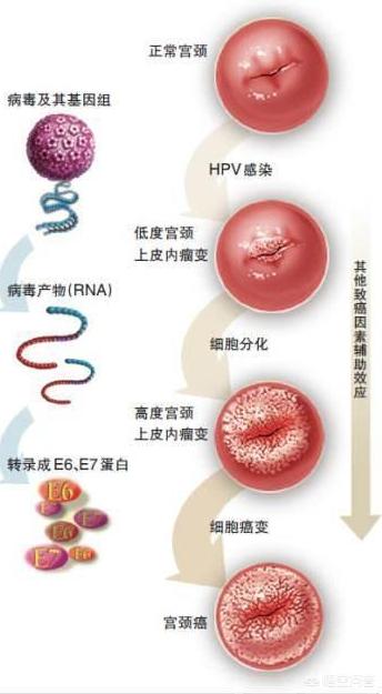 头条问答 - hpv阳性31高危亚型好治疗吗?(9个回答)