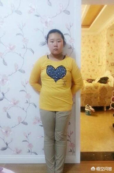 林妙可胸部:为什么有的女孩小时候长得丑，长大后会漂亮？