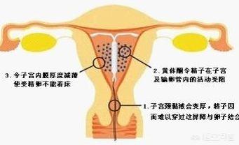 节育环有哪几种图片，节育环可以不取吗需要注意什么