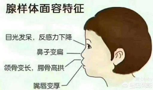 鼻子发育过程图解图片