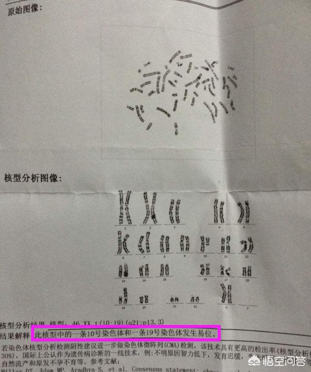 胚胎发育过程图:为何腹中胚胎会停止发育？如何预防再次发生？