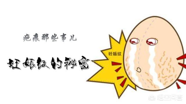 怀孕多久会长妊娠纹？为什么会长妊娠纹？插图49