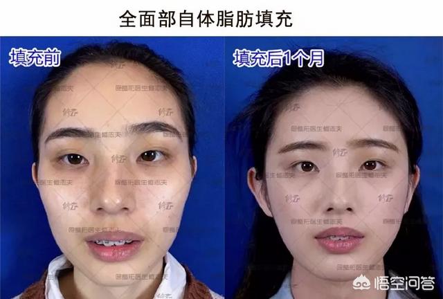 程莉莎个人资料:明星是怎样保持肌肤年轻的？