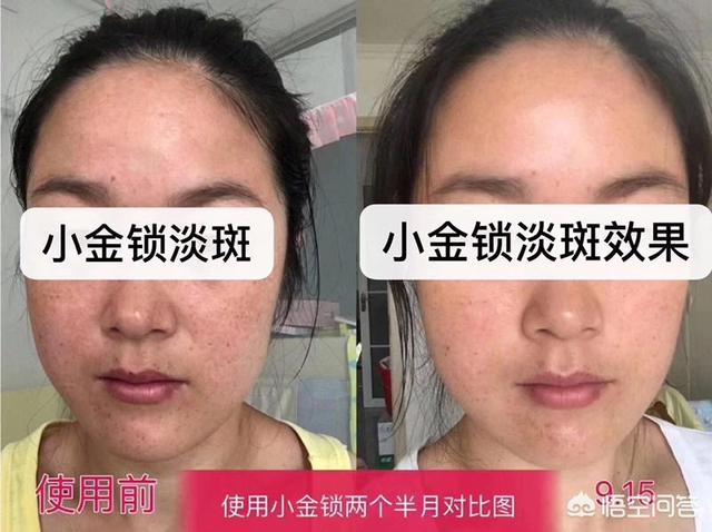 美白淡斑的方法有哪些？