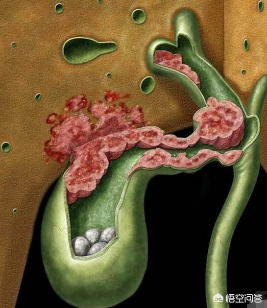 人的胆囊有多大?-惠修网