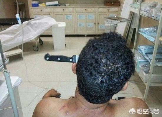 箭杀:古装剧打仗，士兵身上中了一箭就死了，射一箭真能杀死一个人吗？