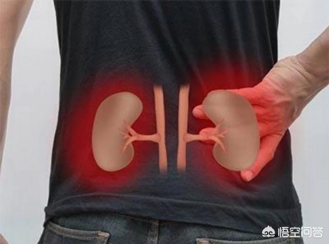 尿道结石症状:怎样确定是得了肾结石还是前列腺？