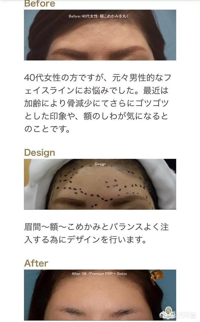 泽尻英龙华图片:有哪些美女明星后来变成了“丑女”？