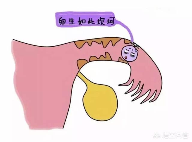 验孕棒如何判断是否怀孕:怎样看验孕棒 验孕棒只有一条杠，但是居然检查怀孕了，是怎么回事？