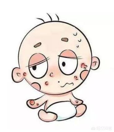 冬天宝宝长湿疹用什么湿疹膏比较好？怎样护理才能不复发？
