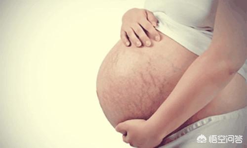 怀孕多久会长妊娠纹？为什么会长妊娠纹？插图46