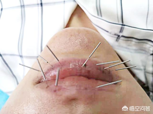 avoderm:有好用的补水喷雾推荐吗？