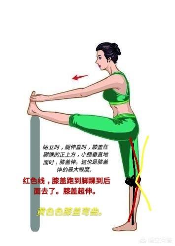 瑜伽狗:下犬式的膝盖是否需要外展？ 瑜伽狗怎么画