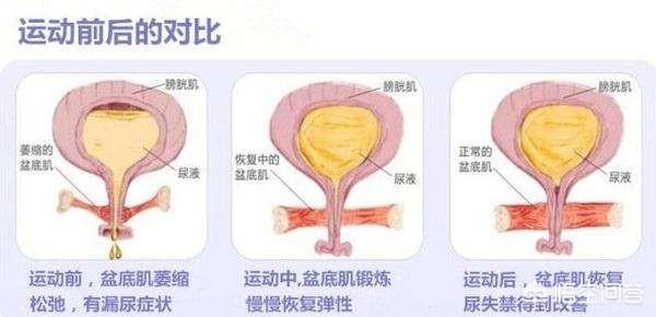 阴道松弛有什么影响,盆底肌松弛会有什么影响？