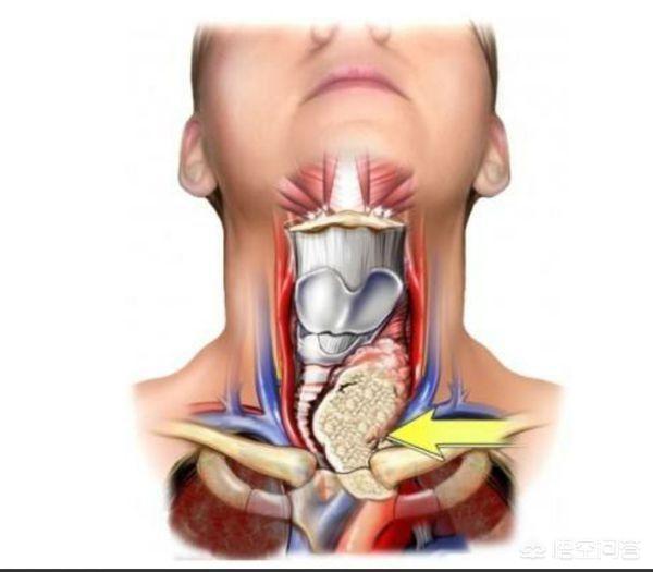 甲状腺左侧叶实质回声病变?甲状腺左侧叶实质病变2类