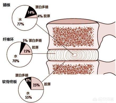 常见脊柱病:常见脊柱病变表现有哪些 哪些病可以引起脊柱源性神经痛？