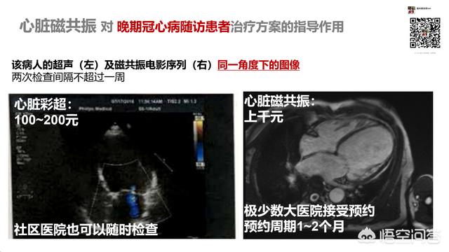 如何判断孩子是有心肌炎,还是有心肌损伤？