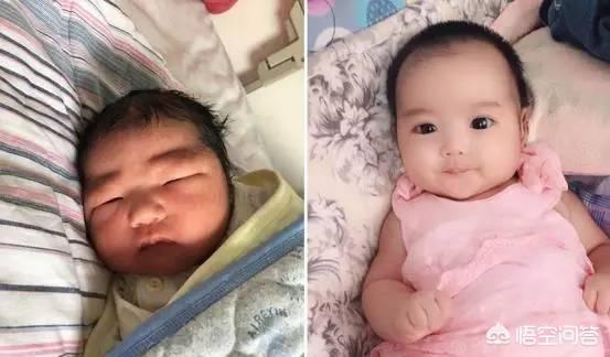 为什么很多新生儿都是单眼皮？最后能不能变成双眼皮？