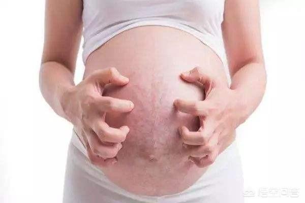 孕妈皮肤发痒是怎么回事，孕期身体发痒，应该怎么办
