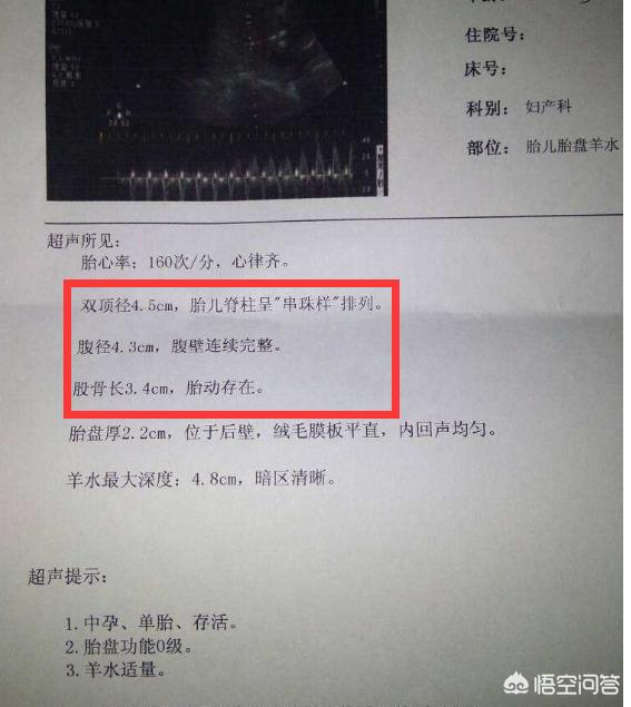 孕期胎儿的各项数值可以看出孩子多少斤吗？其判断依据是什么？