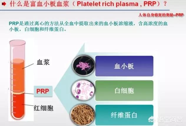 泽尻英龙华图片:有哪些美女明星后来变成了“丑女”？