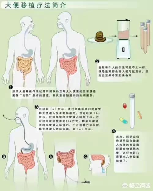 病人排泄物处理记录:如果有一天医学证明人的排泄物可以治疗癌症，你会配合治疗吗？
