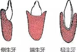牙齿折断有几种:有什么动物的牙齿是可以再生的吗？