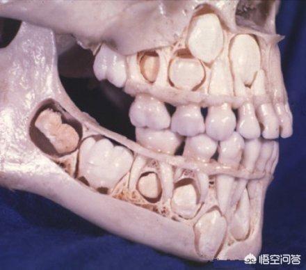牙齿折断有几种:有什么动物的牙齿是可以再生的吗？