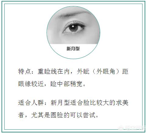 孙娜恩整容:双眼皮有哪几种类型，如何选择适合自己的双眼皮类型