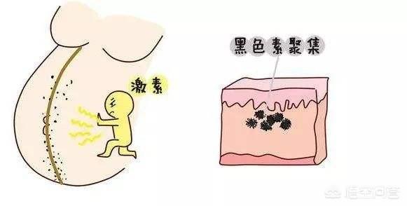 <a href=https://maguai.com/list/256-0-0.html target=_blank class=infotextkey>朋友圈</a>专用图:准妈妈肚子上为啥会有妊娠线？妊娠线会一直存在吗？