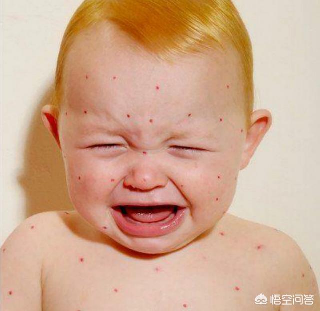 小儿急疹与麻疹是一回事吗？(幼儿急疹就是麻疹吗)