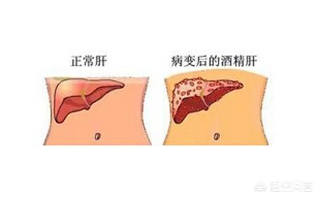 喝酒呕吐后吃什么对肝脏好:喝酒之前吃什么保护肝脏 长期喝酒导致肝脏不舒服，喝蒲公英茶可以起到护肝的作用吗？