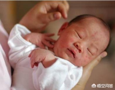 4个月的宝宝有湿疹，有什么办法？