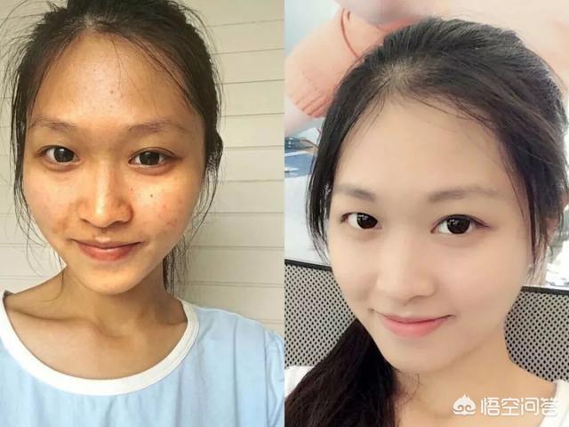 朱正廷带狗狗走红毯:一白真的能遮百丑吗？肤色白对颜值真的重要吗？