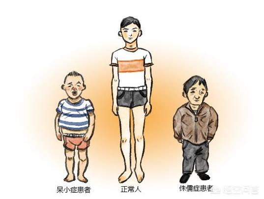 逼着睡都不行,很难入睡其他网友回答:生长激素缺乏性侏儒症又称垂体性