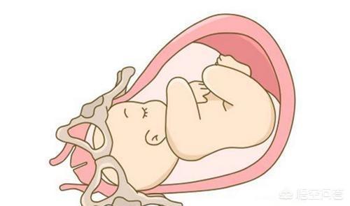 怀孕需要的条件都有哪些，有没有什么办法促进胎宝宝入盆