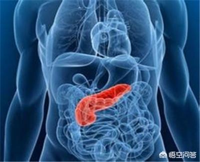 女性胰腺炎的症状是什么:胰腺炎都会疼痛吗？胰腺炎有哪些症状？