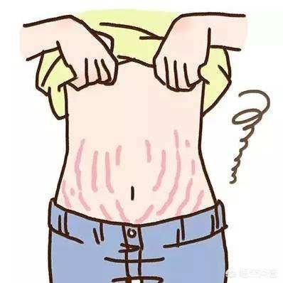 怀孕多久会长妊娠纹？为什么会长妊娠纹？插图48