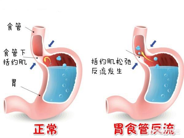 波利特:尼古拉特斯拉和通古斯大爆炸两者之间，真的有联系吗？