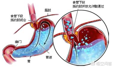 波利特:尼古拉特斯拉和通古斯大爆炸两者之间，真的有联系吗？