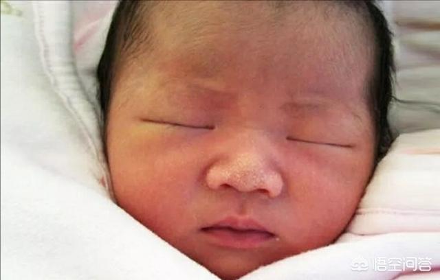 新生儿毒性红斑，为什么有的初生婴儿皮肤问题很多该如何应对
